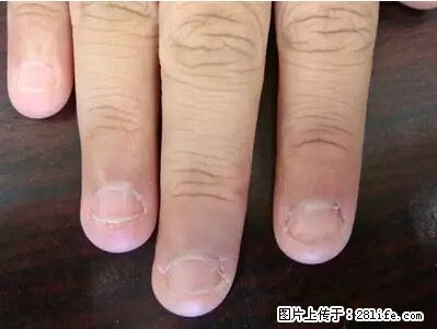 剪指甲、挖耳屎,这些日常小动作竟隐藏大危害! - 兴安盟生活资讯 - 兴安盟28生活网 xam.28life.com